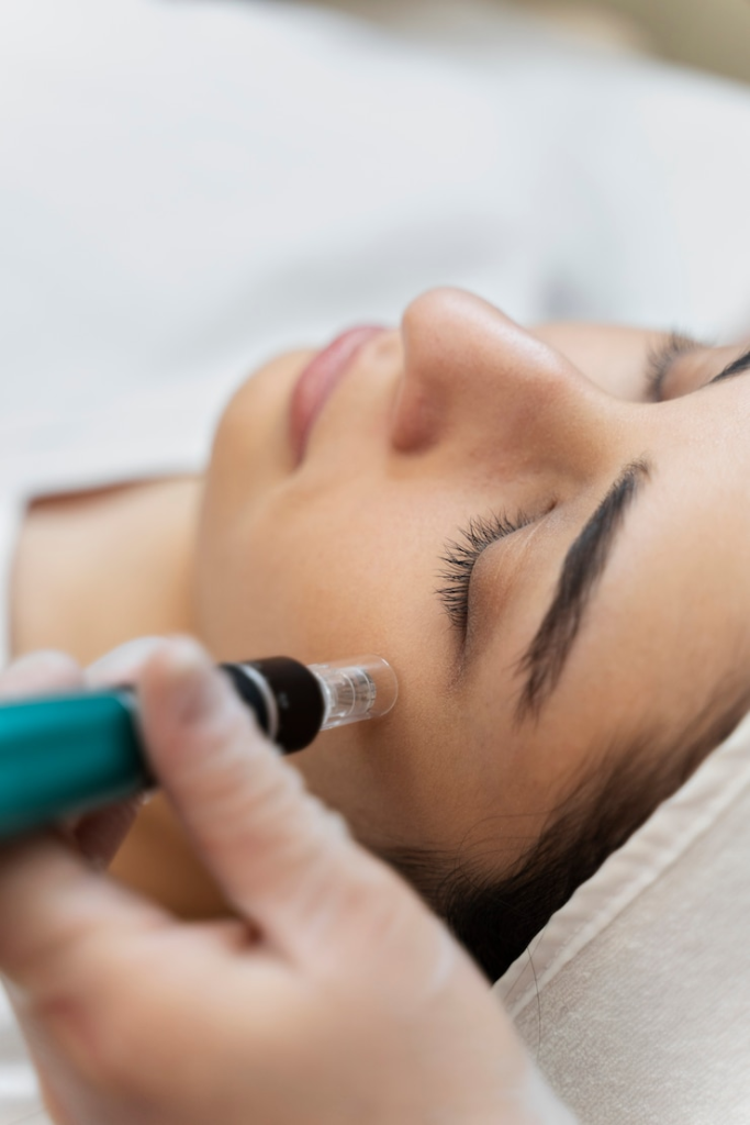 Discover the Benefits of Microneedling: Reveal Glowful Skin with Hyaluronic Acid and PRP